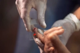 SUS amplia tratamento da malária e inclui nova medicação para crianças