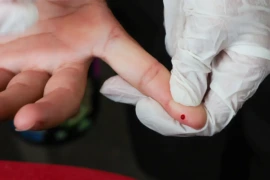 SUS passa a disponibilizar teste rápido para diagnóstico de dengue na rede pública